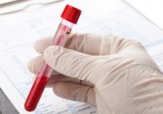 Blood Test Drug Drink Driving NSW