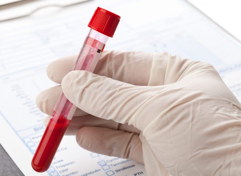 Blood Test Drug Drink Driving NSW
